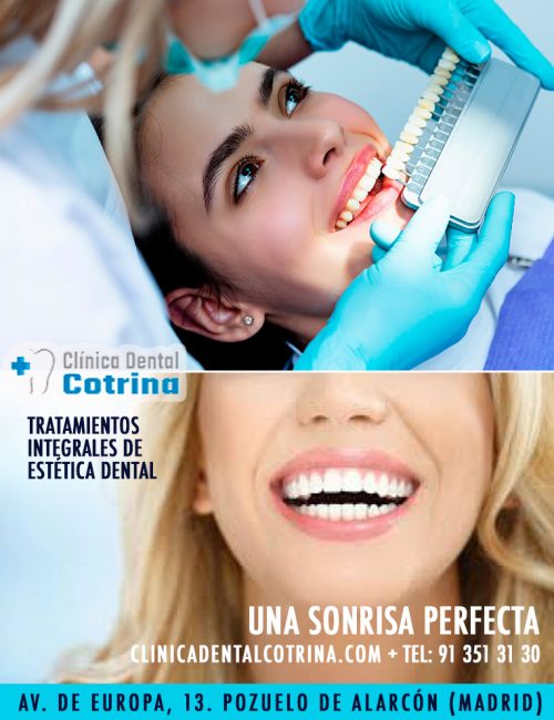 CLÍNICA DENTAL COTRINA. “SONRISAS PERFECTAS EN POZUELO DE ALARCÓN”. TRATAMIENTOS AVANZADOS DE ESTÉTICA DENTAL. Los tratamientos de estética dental buscan mejorar la apariencia de la sonrisa, corrigiendo imperfecciones como manchas, fracturas, malposiciones o asimetrías. Estos tratamientos pueden incluir carillas, blanqueamiento, ortodoncia, coronas estéticas y cirugía de encías, entre otros. Consúltenos. Dirección: Avenida de Europa, 13. 28224 Pozuelo de Alarcón. Teléfono: 91 351 31 30. https://clinicadentalcotrina.com TIPOS DE TRATAMIENTOS: * #Ortodoncia: Corrige la posición de los dientes y los problemas óseos cuando el niño esta en crecimiento o si no está en crecimiento con cirugía #ortognática, para así lograr una sonrisa más armoniosa y una mejor mordida. * Diseño de sonrisa: Es un enfoque integral que combina varios tratamientos para lograr una sonrisa estética y personalizada, considerando la forma, tamaño, color y posición de los dientes, así como la línea de la encía. * #Carillas dentales: Son finas láminas que se adhieren a la parte frontal del diente para mejorar su forma, tamaño, color o posición. * #Coronas o Fundas : Cubren el diente dañado o deteriorado, restaurando su forma, tamaño y función, además de mejorar su apariencia estética. * #Blanqueamiento dental: Aclara el color de los dientes y unifica dicha tonalidad en toda la dentadura. * Cirugía plástica en la encía (Gingivoplastia) junto a la Periodoncia : Permite remodelar la encía para corregir problemas como una sonrisa gingival (demasiado visible) o encías irregulares y a la vez tratar cualquier tipo de enfermedad de la encía. * Reconstrucciones estéticas: Reparan dientes dañados por caries, fracturas o desgaste, utilizando materiales que imitan la apariencia natural del diente. #esteticadental #blanqueamientodental #diseñodesonrisa #dentistaspozuelo #clinicasdentalespozuelo #gingivoplastia #periodoncia #ortodonciadental #blanqueardientes #tratamientosdentales #disyuccionmaxilar #asimetriadental #alineadoresdentales